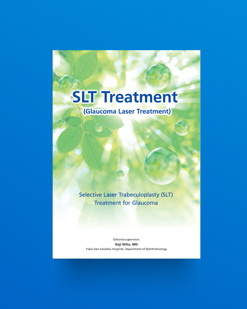 SLT Treatment for Glaucoma